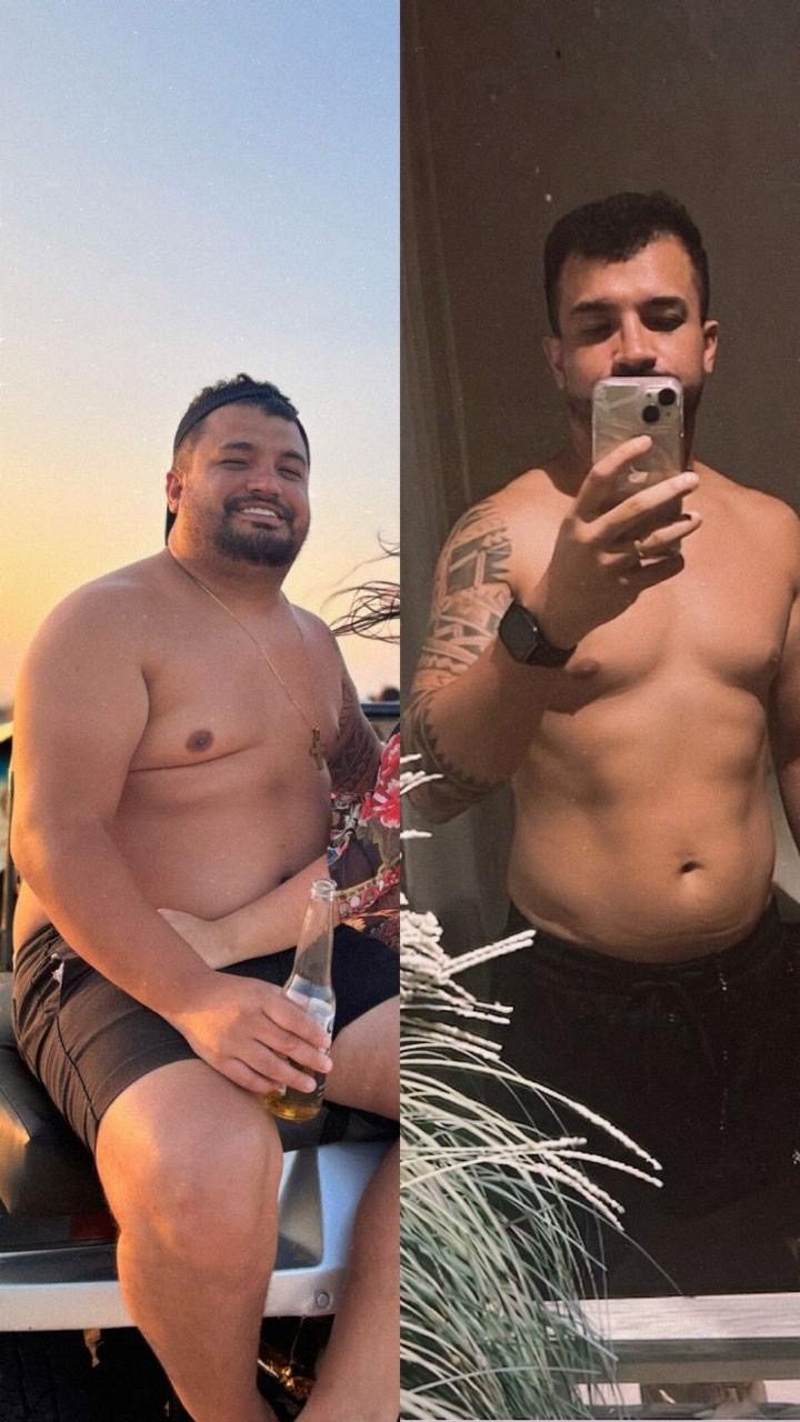 Resultado de recomposição corporal com protocolo do Dr. João Paulo